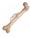 Саркома кости: диагностика и успешное лечение 