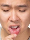 как лечить язвочки во рту